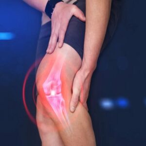 Patellar Stabilization in Islamabad