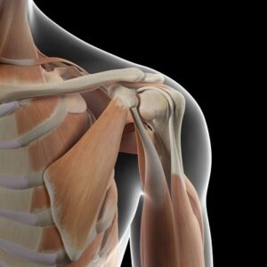 Subacromial decompression in Islamabad