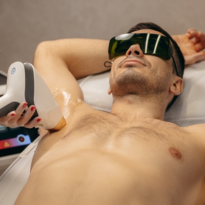 Laser Hair Removal in Islamabad
