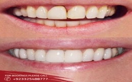 genral-dentistry-in-Islamabad