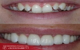 genral-dentistry-treatment