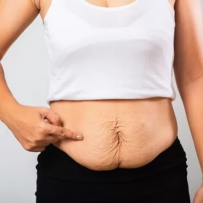 Bariatric Surgery in Islamabad