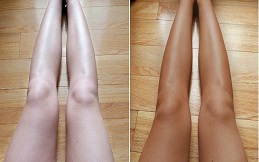 Full Body Whitening Injection