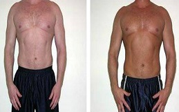 Full Body Whitening