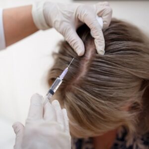 Mesotherapy Cost in Islamabad