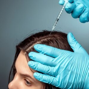 Stem Cell Therapy for Hair Loss in Islamabad