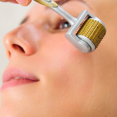 Derma Roller Treatment cost in Islamabad