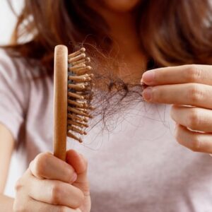 Hair Loss Treatment Cost in Islamabad