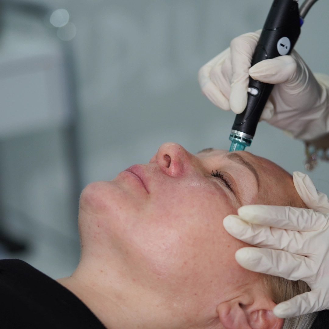Where Can You Get Hydrafacial in Islamabad?
