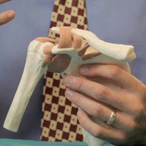 Latarjet in Islamabad