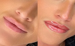 Best Lip Tinting in Islamabad