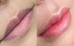 Best Lip Tinting result in Islamabad