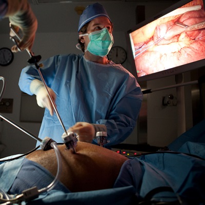 Laparoscopic Appendectomy in Islamabad
