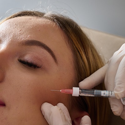 Cheek Filler Injection in islamabad