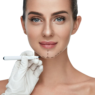 Genioplasty in Islamabad & Pakistan