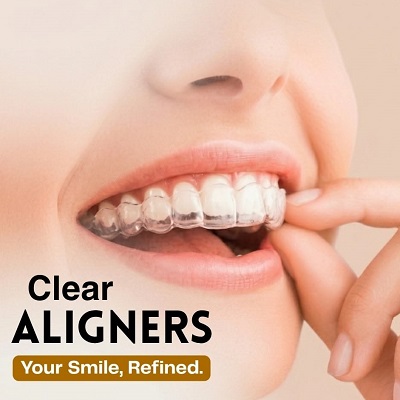 Teeth Aligners in Islamabad