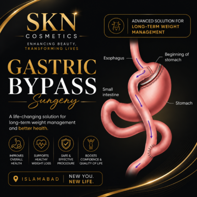 Gastric Bypass Surgery in Islamabad