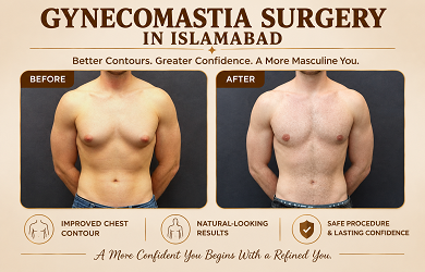gynecomastia surgery in Islamabad