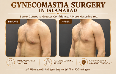 gynecomastia surgery in Islamabad