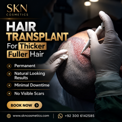 Hair transplant in Islamabad & Pakistan